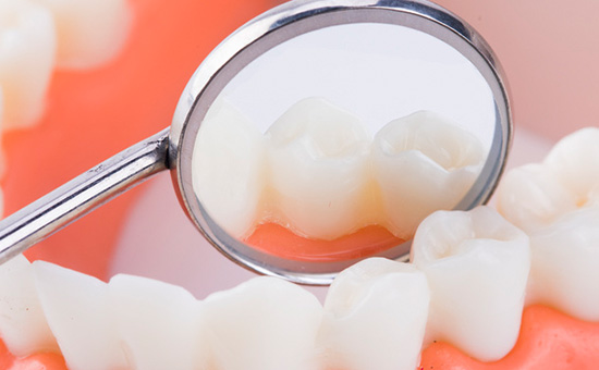 合肥种植牙专题：合肥好的种植牙医院介绍！江苏种植牙集采更新消息2023(图1)