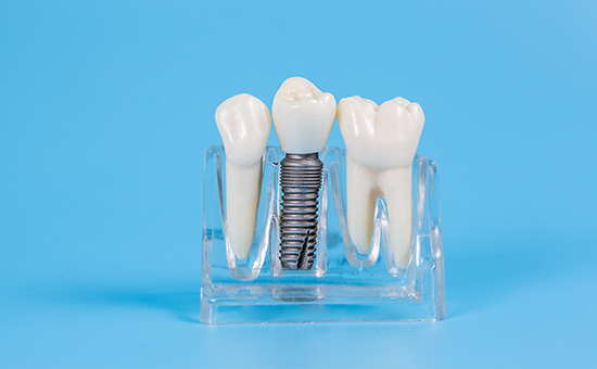 合肥看牙去哪个医院比较好-合肥弗莱堡口腔医院(图1)