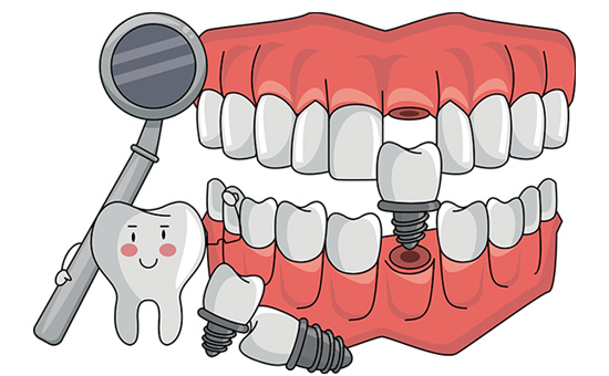 合肥牙齿美白医院在哪,牙齿美白修复多少钱(图1)
